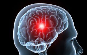 dolor_de_cabeza_cerebro
