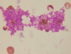 moratones purpura