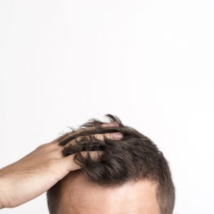 Cómo evitar la caída del cabello